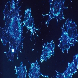 Investigadores rusos confirman que alga marina frena crecimiento de las células cancerosas