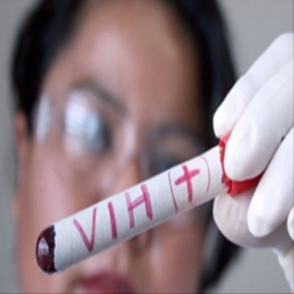 VIH sigue imparable, en Yucatán se registran más de dos casos al día